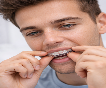 Mutlukent şeffaf plak tedavisi yapan dent alyans diş kliniği tarafından yapılmış bir görünmez diş teli uygulaması