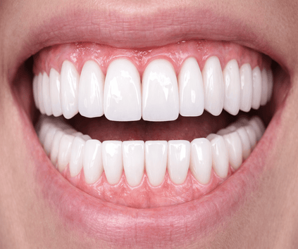 Çayırova zirkonyum diş kaplama işlemleri yapan Dent alyans diş kliniği ile hazırlanmış bir zirkonyum diş örneği