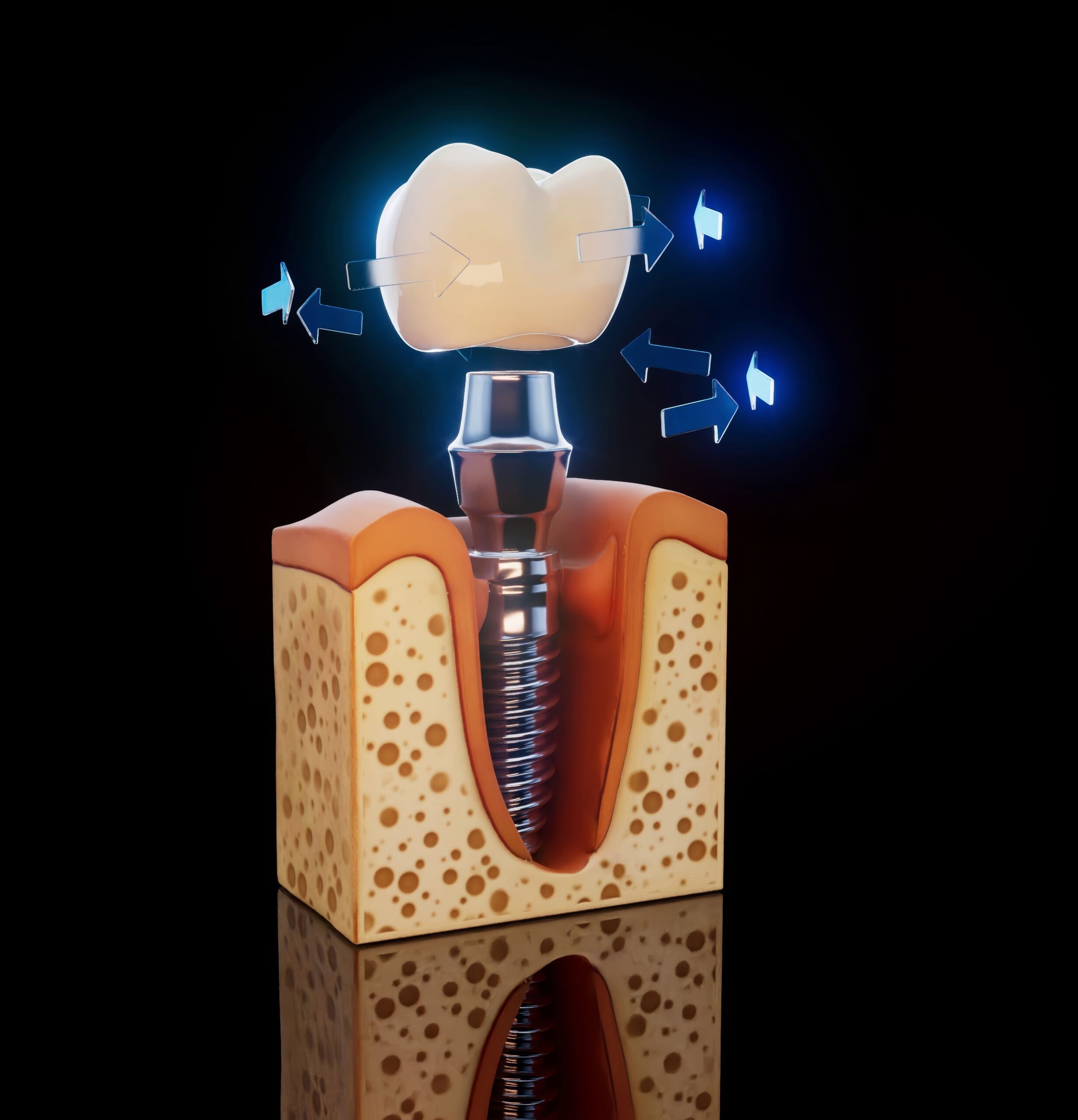 İmplant Diş Fiyatları 2026